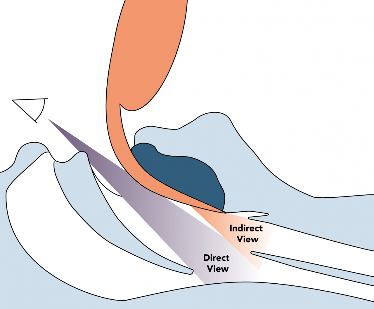 Laryngoscopes theguidewire