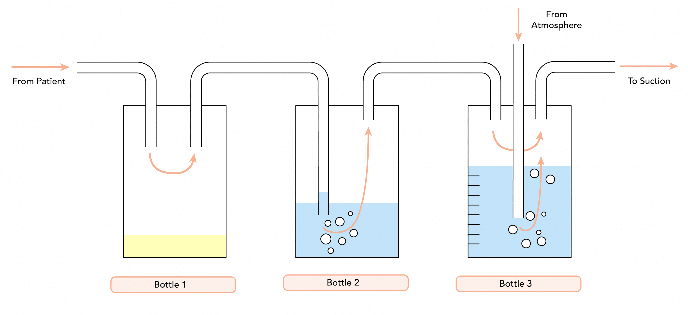 3 bottle chest drain system