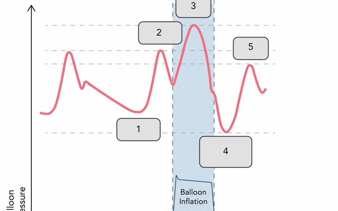 What do the different pressures labelled on the waveform represent?