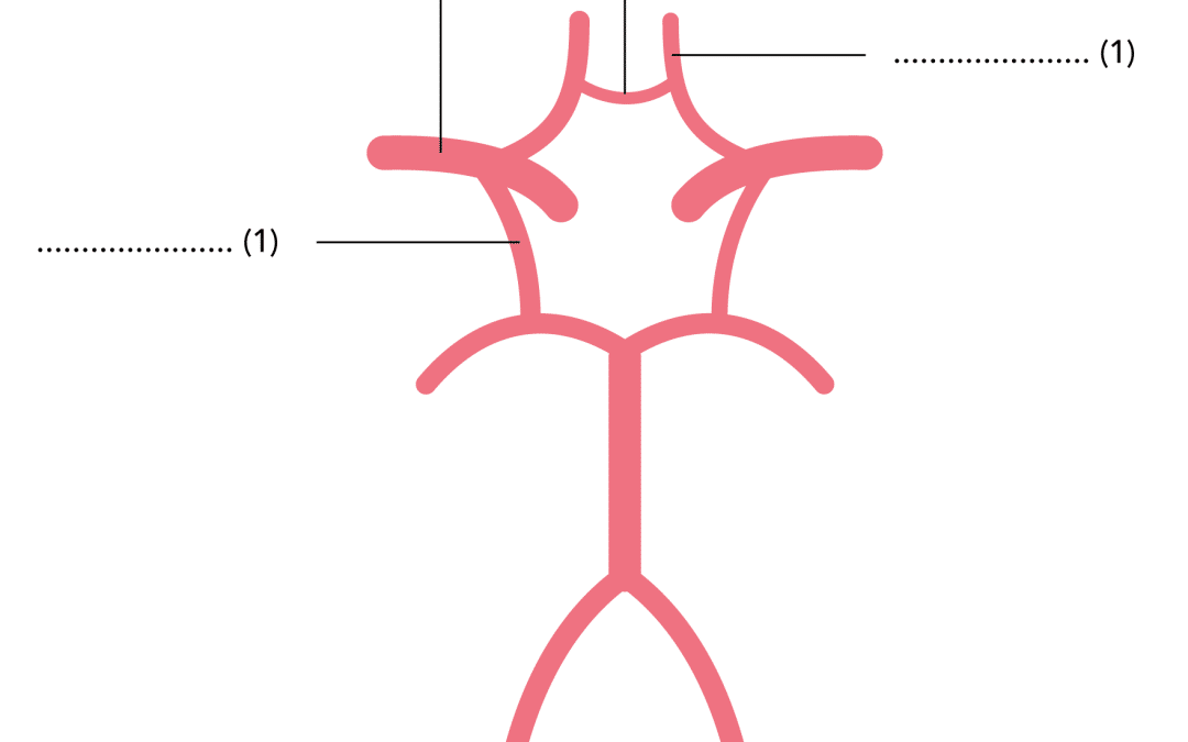 Name the arteries of the cerebral circulation which are labelled?